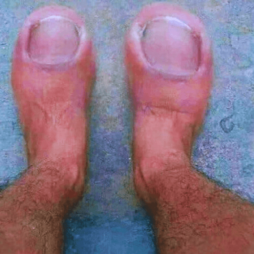 goofy ahh toe pics